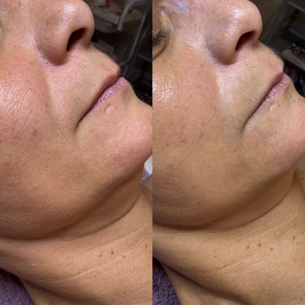 01B211A5 4135 48E2 A67B E2EA6C403A34 1024x1024