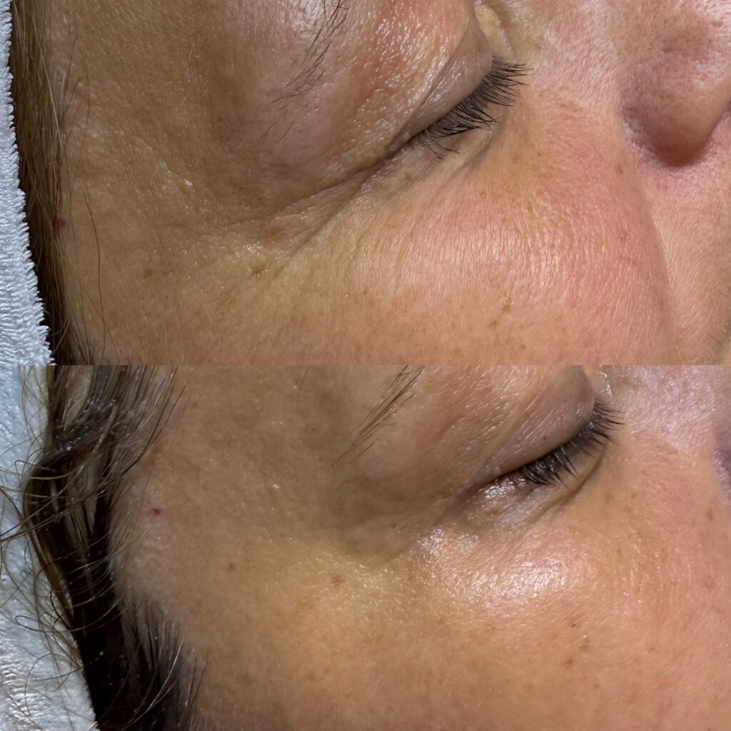 417F0EE8 4D05 4A70 B4D3 E6E55E535955 1024x1024