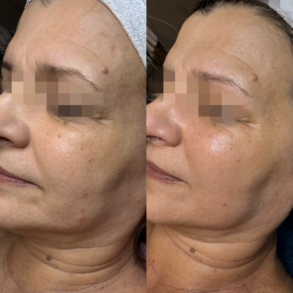 0a693f14 1717 4eef b4c5 dd3081cf2774