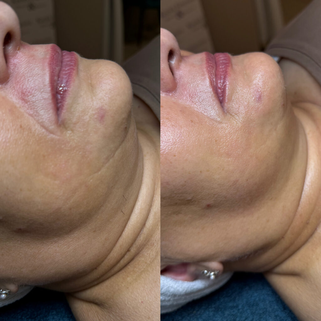 f29ce721 d46c 43ff aefd f9b5b9c0ff07